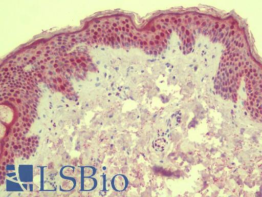 ANKLE1 Antibody - Anti-ANKLE1 antibody IHC staining of human skin. Immunohistochemistry of formalin-fixed, paraffin-embedded tissue after heat-induced antigen retrieval. Antibody concentration 5 ug/ml.