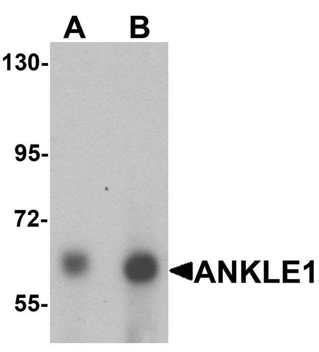 ANKLE1 Antibody - Western blot analysis of ANKLE1 in 293 cell lysate with ANKLE1 antibody at (A) 1 and (B) 2 ug/ml.