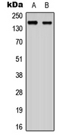 ANKRD30A / NY-BR-1 Antibody - Western blot analysis of ANKRD30A expression in SHSY5Y (A); NIH3T3 (B) whole cell lysates.