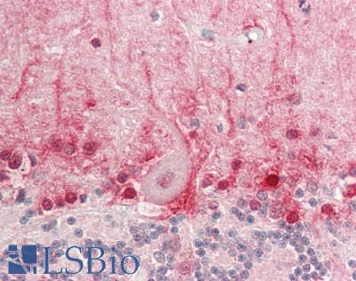 ANKRD30A / NY-BR-1 Antibody - Human Brain, Cerebellum: Formalin-Fixed, Paraffin-Embedded (FFPE)