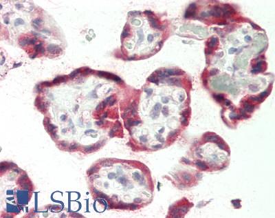 ANKRD44 Antibody - Human Placenta: Formalin-Fixed, Paraffin-Embedded (FFPE)
