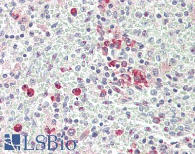 ANKRD44 Antibody - Human Spleen: Formalin-Fixed, Paraffin-Embedded (FFPE)