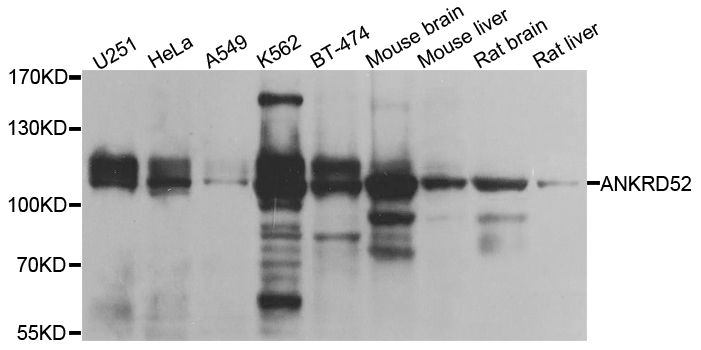 ANKRD52 Antibody - Western blot blot of extracts of various cell lines, using ANKRD52 antibody.