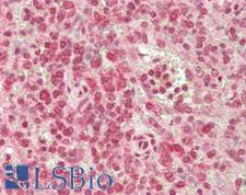 ANKRD52 Antibody - Human Spleen: Formalin-Fixed, Paraffin-Embedded (FFPE)