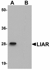 ANKRD54 / LIAR Antibody - Western blot of ANKRD54 in mouse kidney tissue lysate with ANKRD54 antibody at 1 ug/ml in (A) the absence and (B) the presence of blocking peptide.