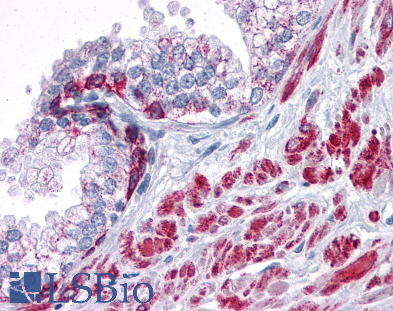 ANKRD54 / LIAR Antibody - Anti-ANKRD54 antibody IHC of human prostate. Immunohistochemistry of formalin-fixed, paraffin-embedded tissue after heat-induced antigen retrieval. Antibody concentration 5 ug/ml.