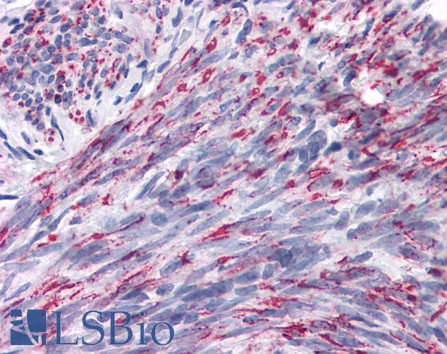 ANKRD54 / LIAR Antibody - Anti-ANKRD54 antibody IHC of human uterus. Immunohistochemistry of formalin-fixed, paraffin-embedded tissue after heat-induced antigen retrieval. Antibody concentration 5 ug/ml.