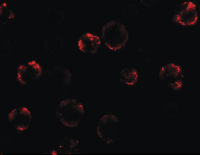 ANOS1 / Anosmin Antibody - Immunofluorescence of Anosmin in MCF7 cells with Anosmin antibody at 20 ug/ml.