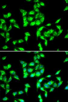 ANTXR1 / TEM8 Antibody - Immunofluorescence analysis of HeLa cell using ANTXR1 antibody. Blue: DAPI for nuclear staining.