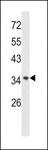 ANXA1 / Annexin A1 Antibody - Western blot of Annexin A1 antibody in A2058 cell line lysates (35 ug/lane). Annexin A1 (arrow) was detected using the purified antibody.