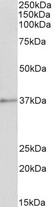 ANXA1 / Annexin A1 Antibody - Goat Anti-Annexin I Antibody (1µg/ml) staining of Pig Spleen lysate (35µg protein in RIPA buffer). Primary incubation was 1 hour. Detected by chemiluminescencence.