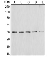 ANXA1 / Annexin A1 Antibody - Western blot analysis of Annexin A1 expression in HEK293T (A); NIH3T3 (B); THP1 (C); Molt4 (D); HepG2 (E) whole cell lysates.