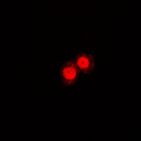 ANXA1 / Annexin A1 Antibody - Immunofluorescent analysis of Annexin A1 staining in NIH3T3 cells. Formalin-fixed cells were permeabilized with 0.1% Triton X-100 in TBS for 5-10 minutes and blocked with 3% BSA-PBS for 30 minutes at room temperature. Cells were probed with the primary antibody in 3% BSA-PBS and incubated overnight at 4 C in a humidified chamber. Cells were washed with PBST and incubated with a DyLight 594-conjugated secondary antibody (red) in PBS at room temperature in the dark. DAPI was used to stain the cell nuclei (blue).
