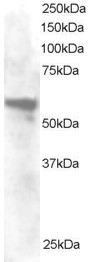 ANXA11 / Annexin XI Antibody - Antibody staining (0.2 ug/ml) of HeLa lysate (RIPA buffer, 30 ug total protein/per lane). Primary incubated for 1 hour. Detected by Western blot of chemiluminescence.