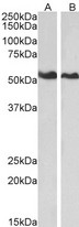 ANXA11 / Annexin XI Antibody - Goat Anti-Annexin A11 Antibody (0.01µg/ml) staining of HeLa (A) and Jurkat (B) lysates (35µg protein in RIPA buffer). Primary incubation was 1 hour. Detected by chemiluminescencence.