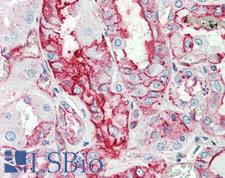 ANXA2 / Annexin A2 Antibody - Human Kidney: Formalin-Fixed, Paraffin-Embedded (FFPE)