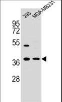 ANXA2 / Annexin A2 Antibody - ANXA2 Antibody western blot of 293,MDA-MB231 cell line lysates (35 ug/lane). The ANXA2 antibody detected the ANXA2 protein (arrow).