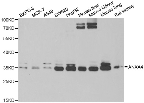 ANXA4 / Annexin IV Antibody - Western blot analysis of extracts of various cell lines, using ANXA4 antibody.