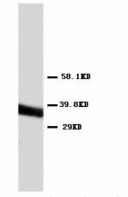 ANXA5 / Annexin V Antibody - Western blot analysis of Annexin V in Jurkat cell lysates.