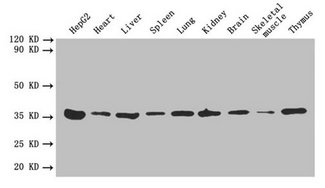 ANXA5 / Annexin V Antibody - Western blot All lanes: ANXA5 antibody at 2 µg/ml Lane 1: HepG2 whole cell lysate Lane 2: Mouse heart tissue Lane 3: Mouse liver tissue Lane 4: Mouse spleen tissue Lane 5: Mouse lung tissue Lane 6: Mouse kidney tissue Lane 7: Mouse brain tissue Lane 8: Mouse skeletal muscle tissue Lane 9: Mouse thymus tissue Secondary Goat polyclonal to rabbit IgG at 1/10000 dilution Predicted band size: 35 kDa Observed band size: 35 kDa