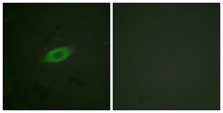 ANXA6/Annexin A6/Annexin VI Antibody - Immunofluorescence analysis of HeLa cells, using Annexin A6 Antibody. The picture on the right is blocked with the synthesized peptide.