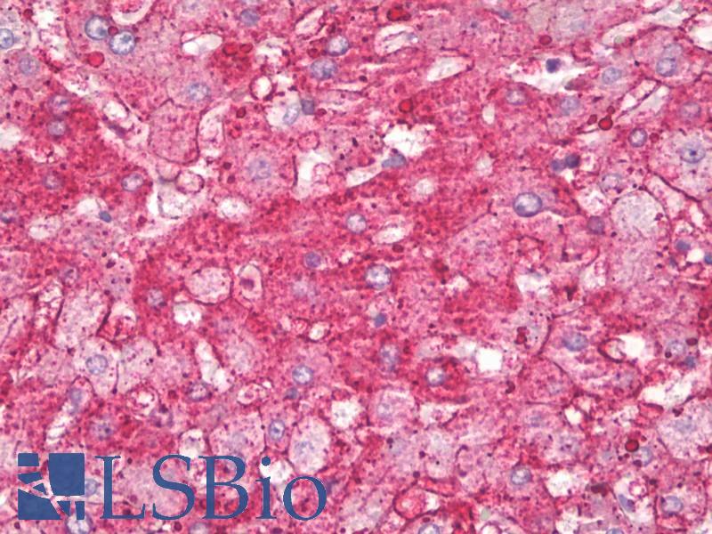 ANXA6/Annexin A6/Annexin VI Antibody - Anti-Annexin VI antibody IHC of human liver. Immunohistochemistry of formalin-fixed, paraffin-embedded tissue after heat-induced antigen retrieval. Antibody dilution 1:100.