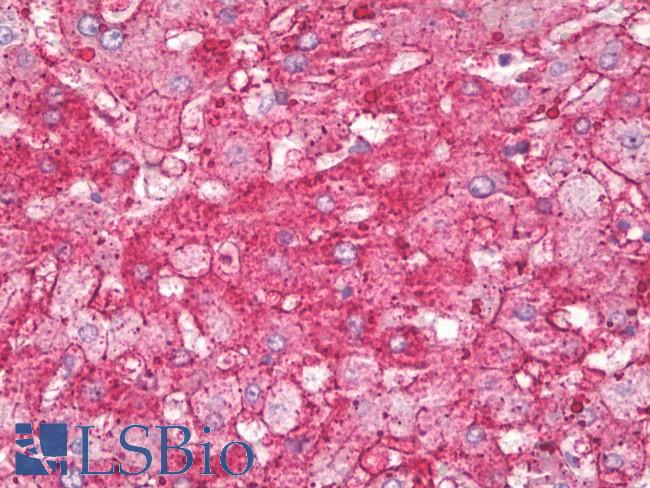 ANXA6/Annexin A6/Annexin VI Antibody - Anti-Annexin VI antibody IHC of human liver. Immunohistochemistry of formalin-fixed, paraffin-embedded tissue after heat-induced antigen retrieval. Antibody dilution 1:100.