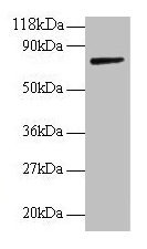ANXA6/Annexin A6/Annexin VI Antibody - Western blot All lanes: Annexin A6 antibody at 2µg/ml + Rat liver tissue Secondary Goat polyclonal to rabbit IgG at 1/10000 dilution Predicted band size: 76, 73 kDa Observed band size: 76 kDa