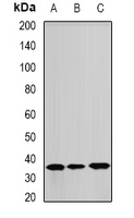 ANXA8L1 Antibody - Western blot analysis of ANXA8L2 expression in A549 (A); HeLa (B); mouse lung (C) whole cell lysates.