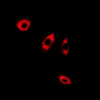 ANXA8L1 Antibody - Immunofluorescent analysis of ANXA8L2 staining in A549 cells. Formalin-fixed cells were permeabilized with 0.1% Triton X-100 in TBS for 5-10 minutes and blocked with 3% BSA-PBS for 30 minutes at room temperature. Cells were probed with the primary antibody in 3% BSA-PBS and incubated overnight at 4 deg C in a humidified chamber. Cells were washed with PBST and incubated with a DyLight 594-conjugated secondary antibody (red) in PBS at room temperature in the dark.