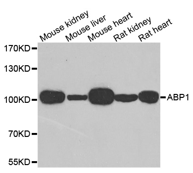 AOC1 Antibody - Western blot analysis of extracts of various cell lines.