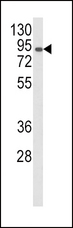 AOC3 / VAP-1 Antibody - Western blot of AOC3 Antibody in CEM cell line lysates (35 ug/lane). AOC3 (arrow) was detected using the purified antibody.