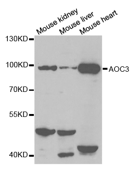 AOC3 / VAP-1 Antibody - Western blot analysis of extracts of various cell lines, using AOC3 antibody.
