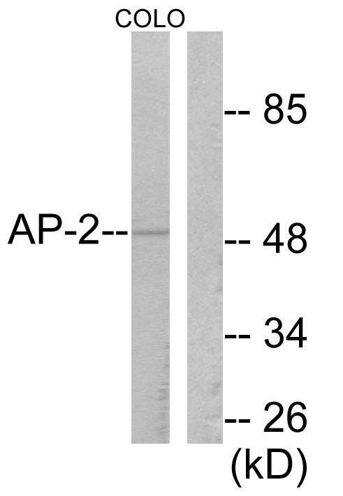 AP-2 Alpha/Beta Antibody - Western blot analysis of lysates from COLO205 cells, using AP-2 Antibody. The lane on the right is blocked with the synthesized peptide.