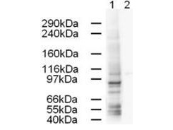 AP1G1 / Adaptin Gamma 1 Antibody - Anti-AP1G1 Antibody - Western Blot. Western blot of Affinity Purified anti-AP1G1 antibody shows strong detection of a 91-kD band corresponding to Human AP1G1 in a HeLa whole cell lysate (lane 1). Peptide competition (using 1 ug/ml of the immunizing peptide) blocks the specific reactivity of this antibody with AP1G1 (lane 2). Approximately 20 ug of each lysate was run on a SDS-PAGE and transferred onto nitrocellulose followed by reaction with a 1:500 dilution of anti-AP1G1 antibody. Detection occurred using a 1:5000 dilution of HRP-labeled Rabbit anti-Goat IgG for 1 hour at room temperature. A chemi-luminescence system was used for signal detection (Roche) using a 60-sec exposure time.