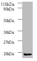 AP1S3 Antibody - Western blot All lanes: AP1S3 antibody at 2µg/ml + A549 whole cell lysate Secondary Goat polyclonal to rabbit IgG at 1/10000 dilution Predicted band size: 19, 20, 13 kDa Observed band size: 19 kDa