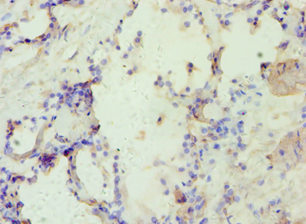 AP2A1 / AP2-Alpha Antibody - Immunohistochemistry of paraffin-embedded human prostate using antibody at 1:100 dilution.