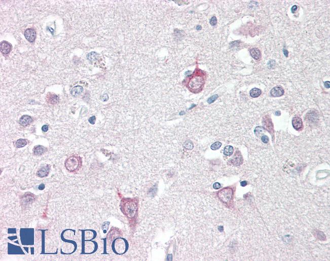 AP3B2 Antibody - Anti-AP3B2 antibody IHC staining of human brain, cortex. Immunohistochemistry of formalin-fixed, paraffin-embedded tissue after heat-induced antigen retrieval.