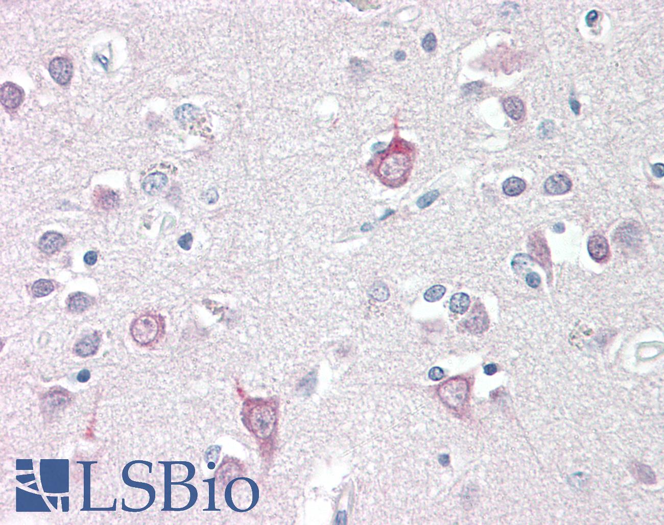 AP3B2 Antibody - Anti-AP3B2 antibody IHC staining of human brain, cortex. Immunohistochemistry of formalin-fixed, paraffin-embedded tissue after heat-induced antigen retrieval.