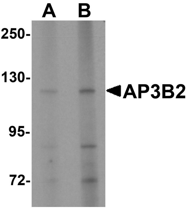 AP3B2 Antibody - Western blot analysis of AP3B2 in rat brain tissue lysate with AP3B2 antibody at (A) 1 and (B) 2 ug/ml.