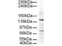 AP3D1 / Adaptin Delta Antibody - Anti-AP3D1 Antibody - Western Blot. Western blot of Affinity Purified anti-AP3D1 antibody shows detection of a 130-kD band corresponding to Human AP3D1 in a HeLa whole cell lysate. The lower molecular weight band most likely represents non-specific binding. Approximately 20 ug of lysate was run on a SDS-PAGE and transferred onto nitrocellulose followed by reaction with a 1:500 dilution of anti-AP3D1 antibody. Detection occurred using a 1:5000 dilution of HRP-labeled Rabbit anti-Goat IgG for 1 hour at room temperature. A chemilumi-nescence system was used for signal detection (Roche) using a 30-sec exposure time.