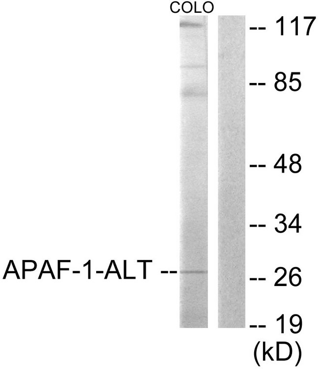 APAF1 / APAF-1 Antibody - Western blot analysis of lysates from COLO205 cells, using APAF-1-ALT Antibody. The lane on the right is blocked with the synthesized peptide.