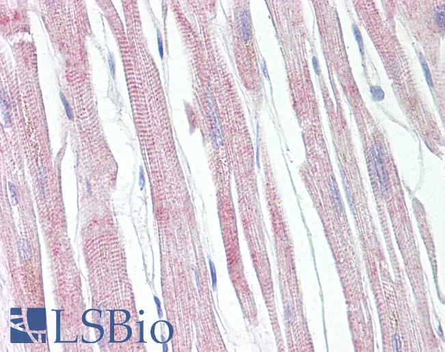 APAF1 / APAF-1 Antibody - Anti-APAF1 / APAF-1 antibody IHC of human heart. Immunohistochemistry of formalin-fixed, paraffin-embedded tissue after heat-induced antigen retrieval. Antibody dilution 1:100.