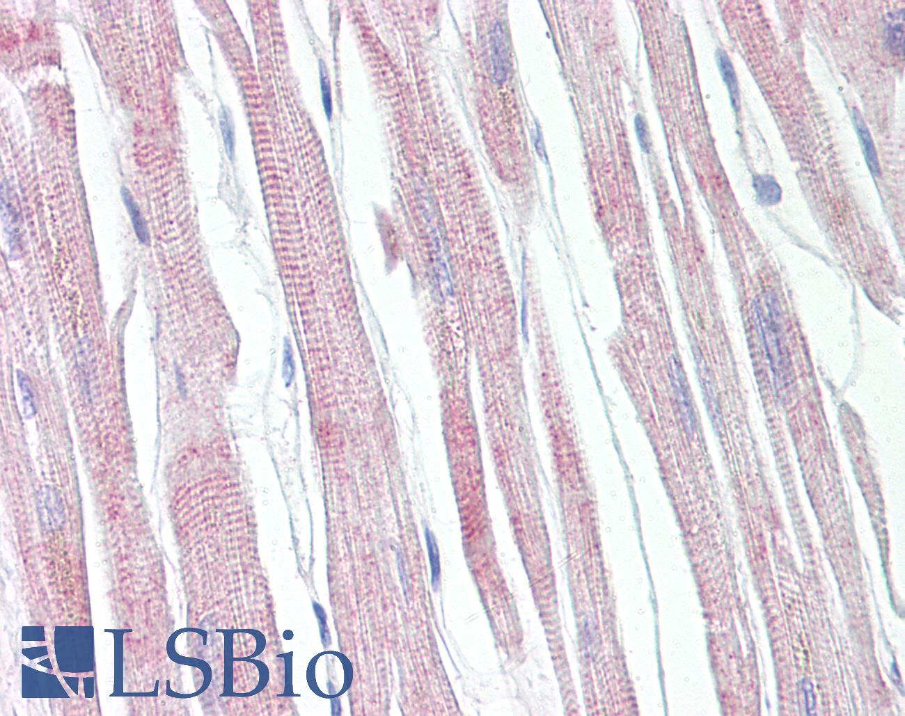 APAF1 / APAF-1 Antibody - Anti-APAF1 / APAF-1 antibody IHC of human heart. Immunohistochemistry of formalin-fixed, paraffin-embedded tissue after heat-induced antigen retrieval. Antibody dilution 1:100.