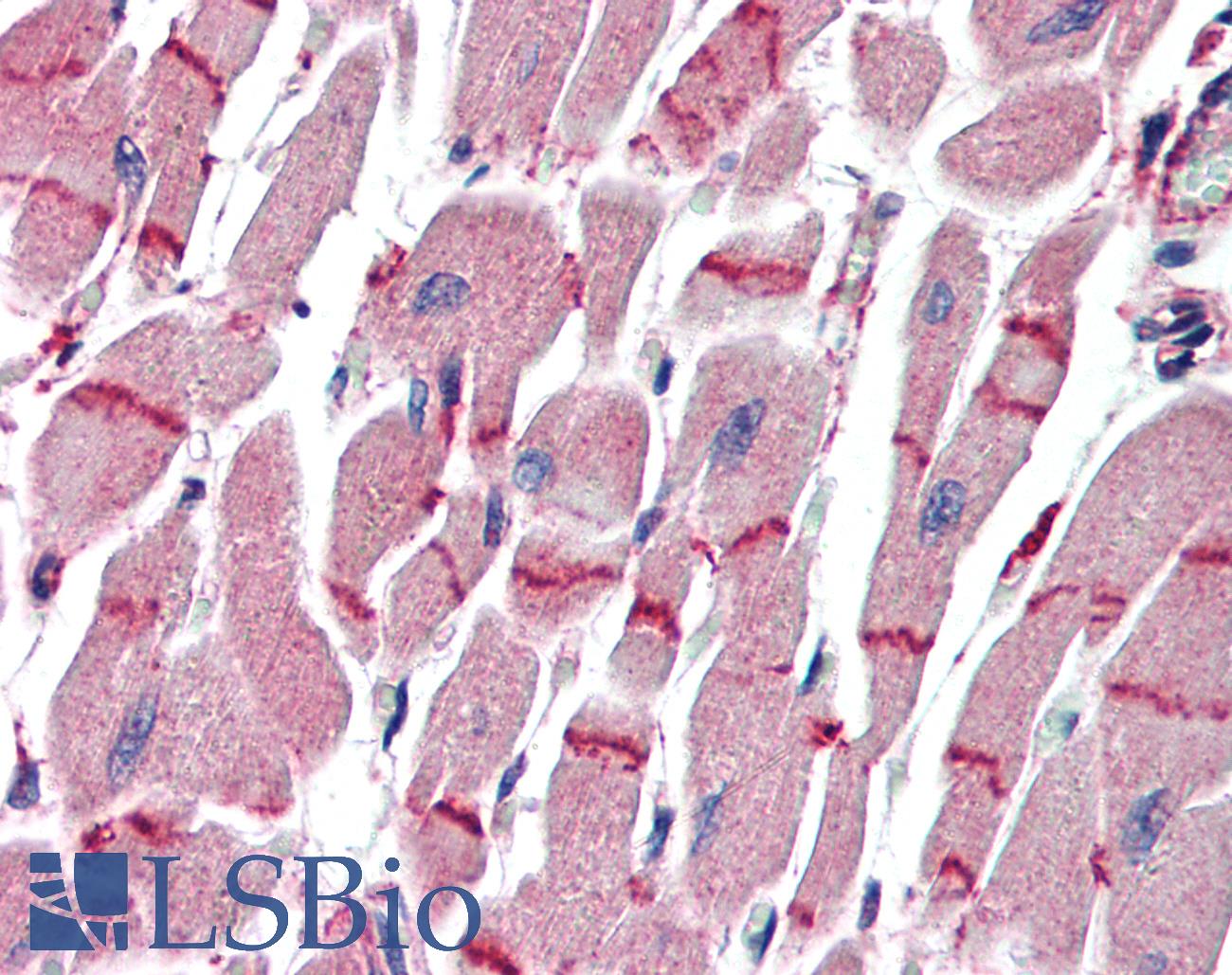 APAF1 / APAF-1 Antibody - Anti-APAF1 / APAF-1 antibody IHC of human heart. Immunohistochemistry of formalin-fixed, paraffin-embedded tissue after heat-induced antigen retrieval. Antibody concentration 10 ug/ml.