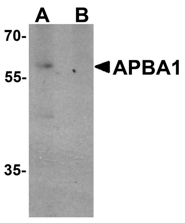 APBA1 / MINT1 Antibody - Western blot analysis of APBA1 in rat brain tissue lysate with APBA1 antibody at 0.5 ug/ml in (A) the absence and (B) the presence of blocking peptide.