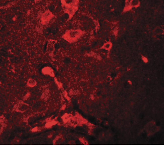 APBA2 Antibody - Immunofluorescence of APBA2 in human brain tissue with APBA2 antibody at 20 ug/ml.