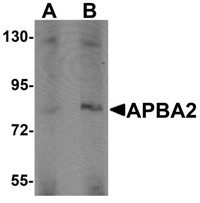 APBA2 Antibody - Western blot analysis of APBA2 in human brain tissue lysate with APBA2 antibody at (A) 1 and (B) 2 ug/ml.