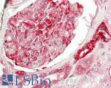 APC6 / CDC16 Antibody - Human Kidney: Formalin-Fixed, Paraffin-Embedded (FFPE)