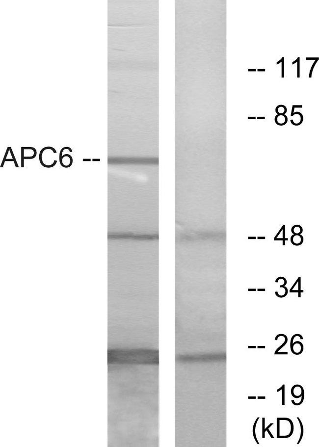 APC6 / CDC16 Antibody - Western blot analysis of lysates from NIH/3T3 cells, using APC6 Antibody. The lane on the right is blocked with the synthesized peptide.